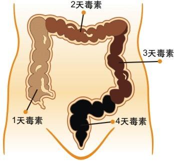 便秘1.jpg